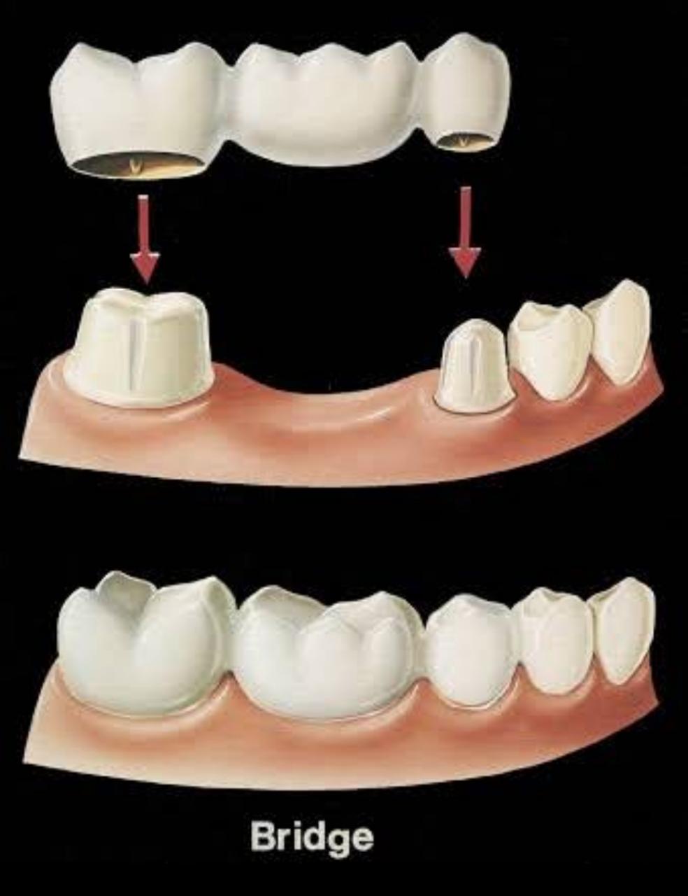 I.S DENTAL CLINIC RAMANATTUKARA